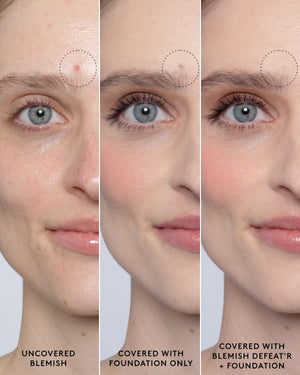 Close-up of model's light-toned face showing an uncovered blemish, a foundation-covered blemish and a foundation and Blemish Defeat'r BHA Spot-Targeting Gel-covered blemish.