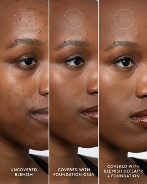 Close-up of model's deep-toned face showing an uncovered blemish, a foundation-covered blemish and a foundation and Blemish Defeat'r BHA Spot-Targeting Gel-covered blemish.